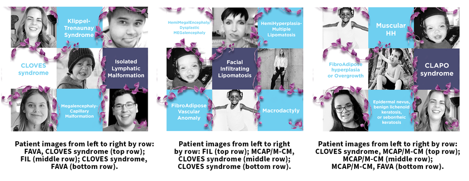 Images of various adult and pediatric patients with FAVA, FIL, CLOVES syndrome, and MCAP/M-CM